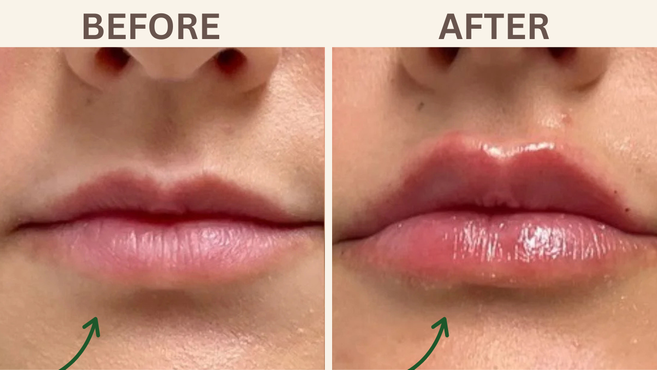 Lip Flip